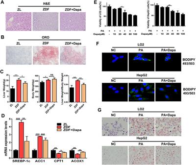 Dapagliflozin Alleviates Hepatic Steatosis by Restoring Autophagy via the AMPK-mTOR Pathway